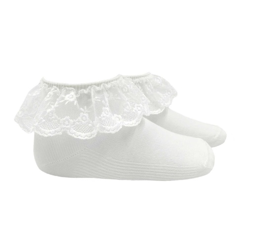 Anklet W/ Bobbin Lace